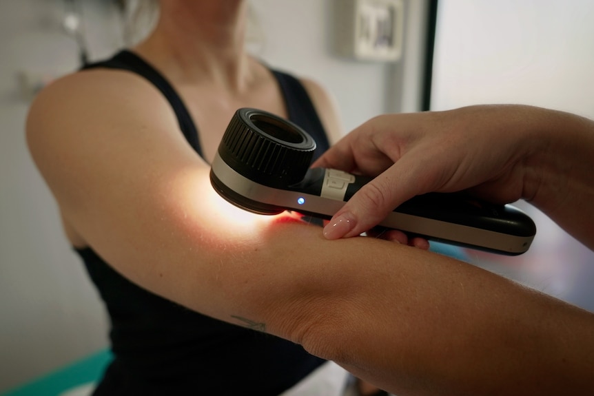 A dermatologist checks the arm of a woman 